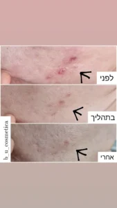 IMG_20211115_130049_293