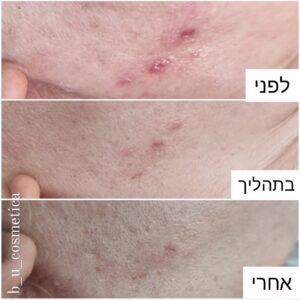 IMG_20211115_130548_955